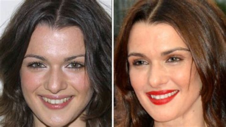 Unveiling Rachel Weisz's Plastic Surgery Secrets: Discoveries And Insights